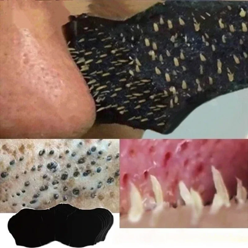 Charcoal Pore Strip - Unisex Mitesser Entfernen Maske Nasen Streifen