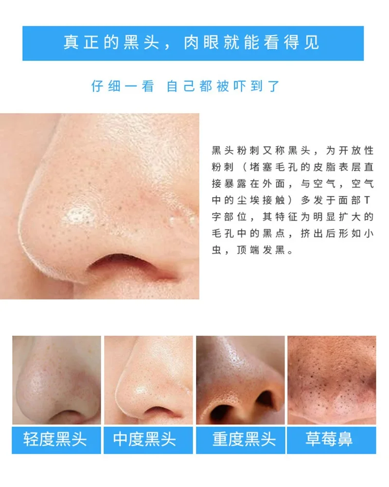 30 Stück Bambuskohle-Nasenstre – Charcoal Pore Strip Bewertung und Preis
