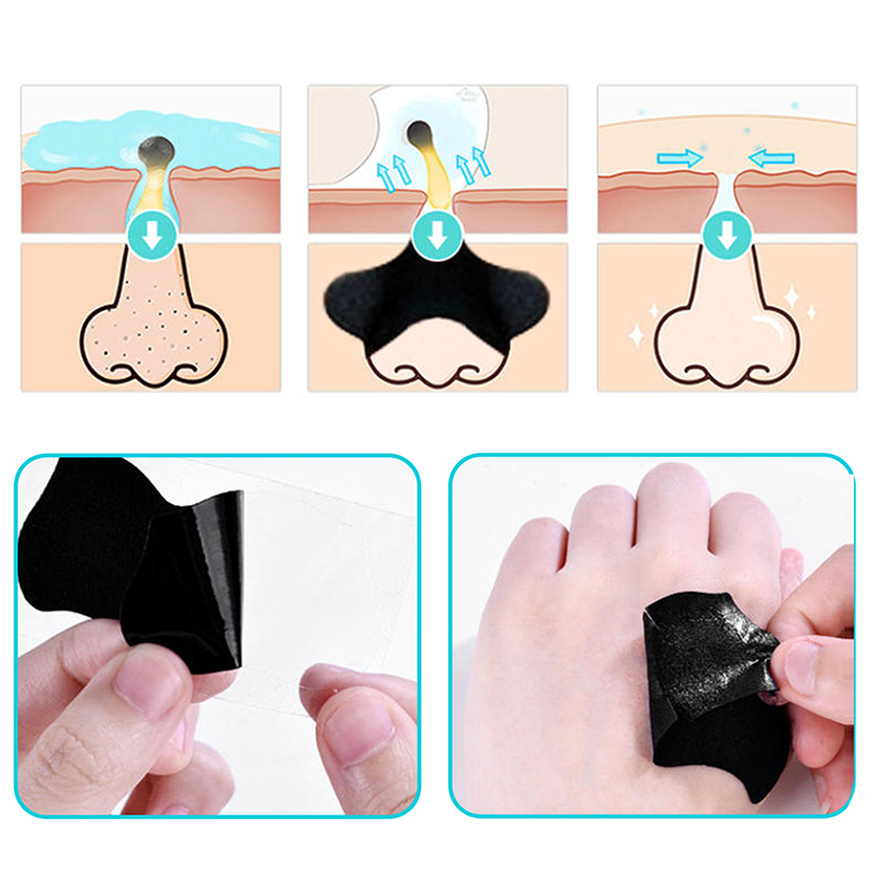 5/15/25/50 Stück Bambuskohle M – Charcoal Pore Strip Bewertung und Preis