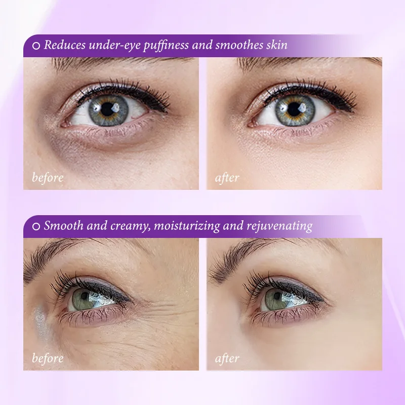 Sofortwirkende Augenringe-Entf – Skincare D'Alba Bewertung und Preis