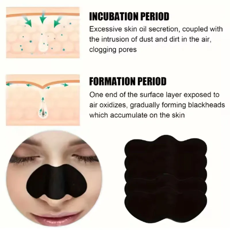 10/20/50 Stück Aktivkohle-Mite – Charcoal Pore Strip Bewertung und Preis